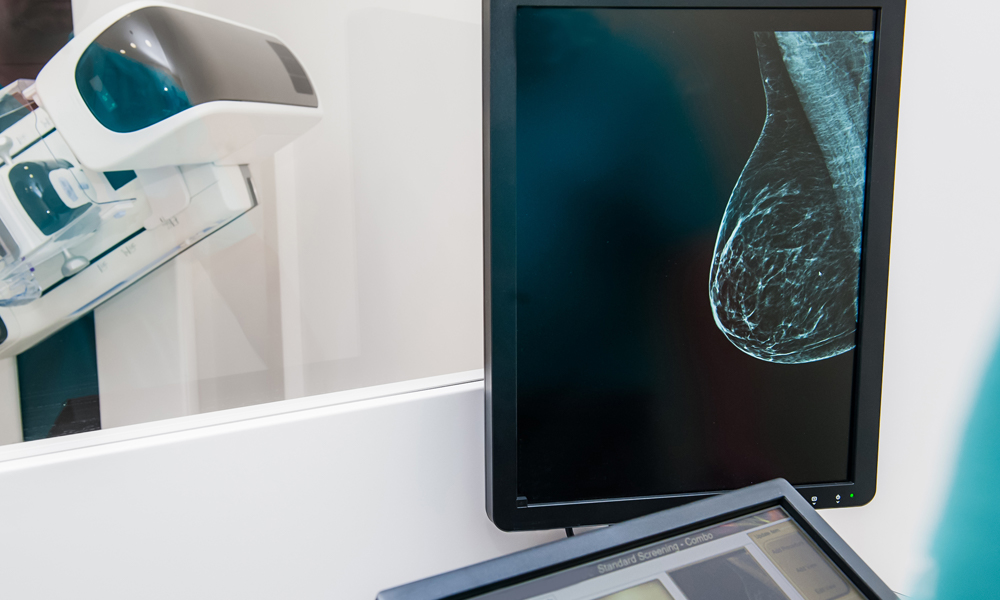 mammogram image of breast on screen